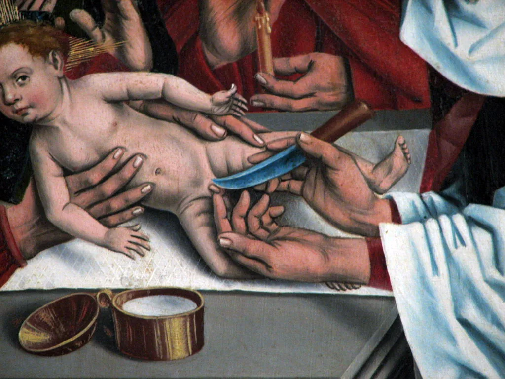 La Circuncisión de Jesús
